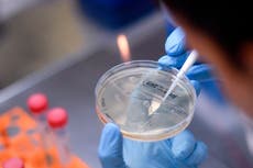 Coronavirus: Carta alerta falsamente que la vacuna se probará solo en las minorías