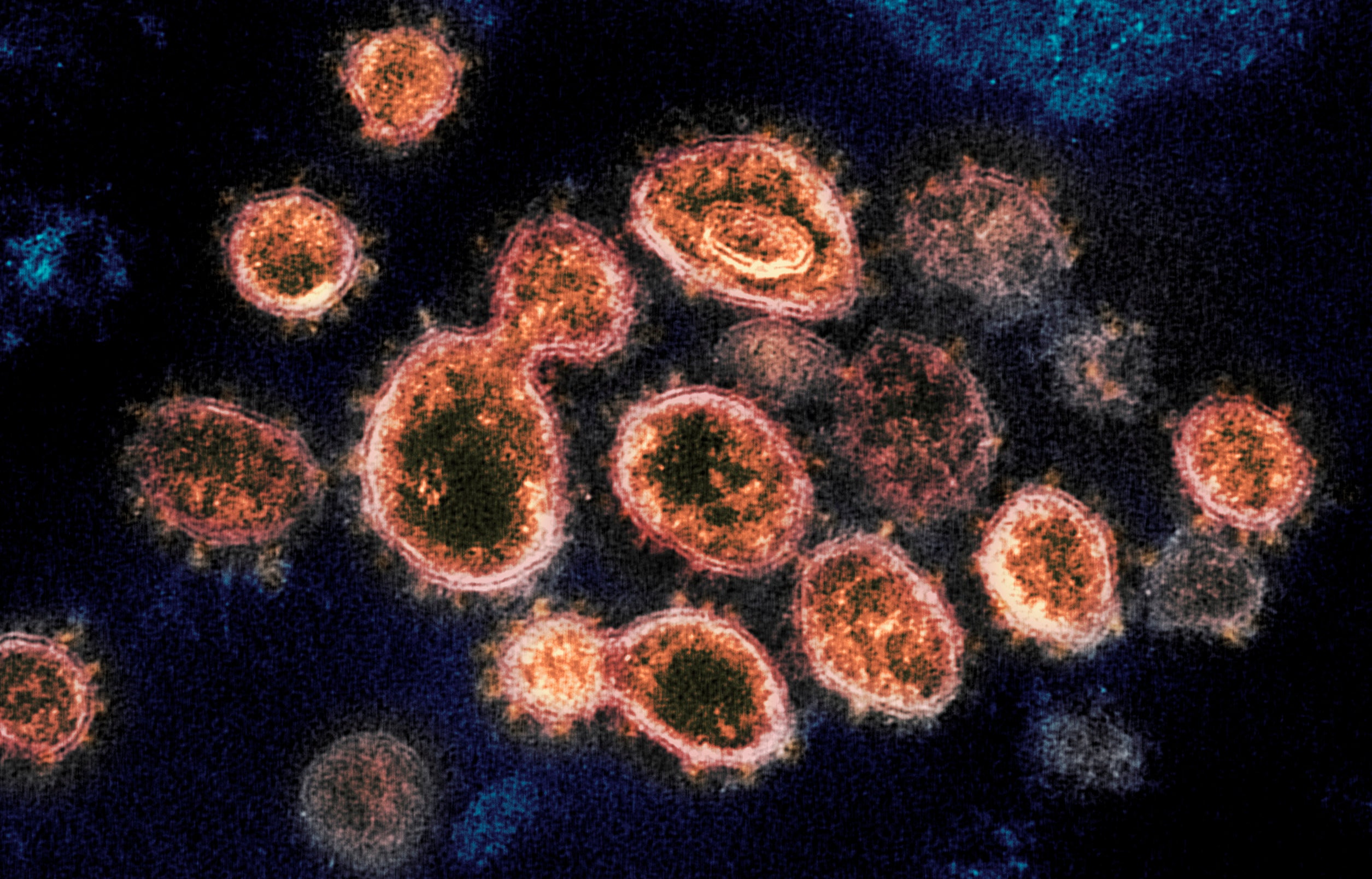 Aerosol de los CDC para el brote de virus.