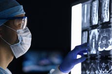 Médico estadounidense perdona 650 mil dólares en facturas médicas a pacientes con cáncer