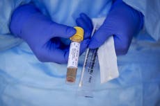 Mujer en Holanda primera persona en morir tras reinfección por Covid