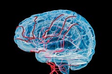 Alzheimer: “reloj de kilometraje” en el cerebro podría facilitar el diagnóstico
