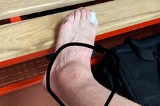 Donny van de Beek ‘presume’ tobillo hinchado y genera preocupación