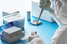 Científicos encuentran tratamientos efectivos para casos Covid graves