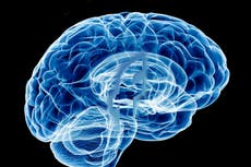 Facebook revela planes para un dispositivo que lee la mente