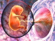 Microplásticos, hallados en placentas de mujeres embarazadas 