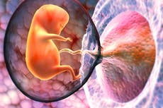 “De gran preocupación”; encuentran microplásticos en placentas de mujeres embarazadas