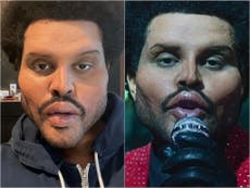 ¿Qué le pasó a The Weeknd en la cara? 