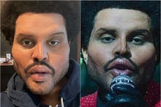 ¿Qué le pasó a The Weeknd en la cara?