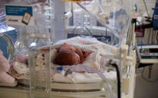 Madre de bebé hospitalizada con Covid-19 advierte sobre piel moteada