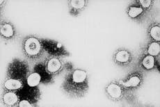 Nuevas variantes del coronavirus pueden tener sus raíces en pacientes inmunodeprimidos, dice destacada científica