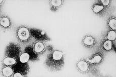 Nuevas variantes del coronavirus pueden tener sus raíces en pacientes inmunodeprimidos, dice destacada científica