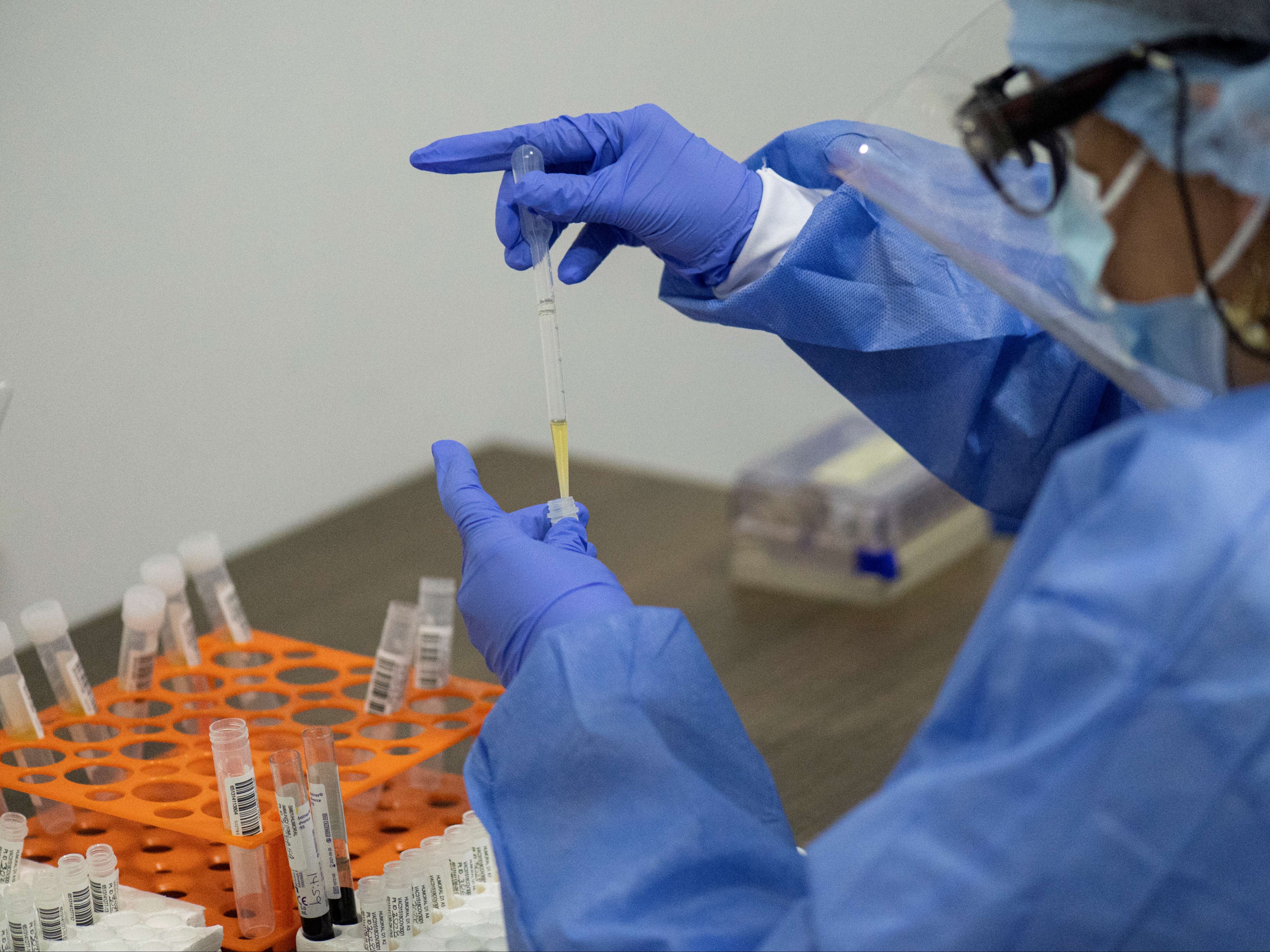 Vacuna Johnson & Johnson proporciona fuerte protección contra COVID