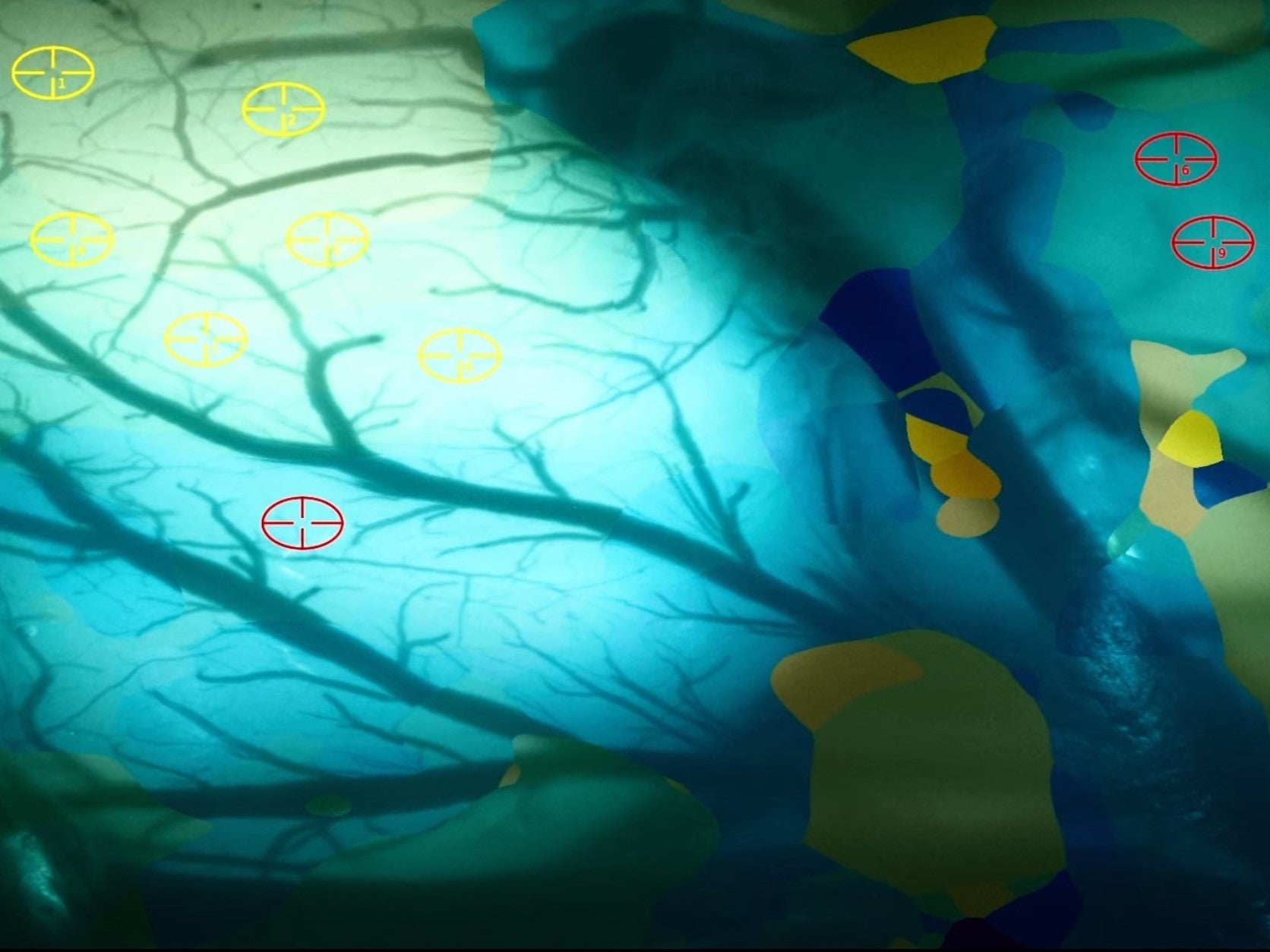 Elon Musk dice que tiene un mono “totalmente feliz” con chip cerebral para jugar videojuegos