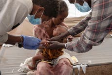 “Tenemos que prepararnos para lo peor”; advierten que miles podrían morir de hambre en Etiopía 