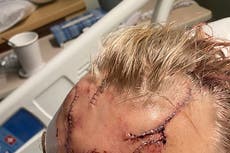 Hombre sobrevive a ataque de oso en zona remota de Alaska