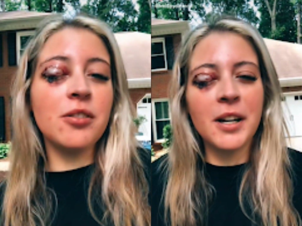 Kelsey Salmon se volvió viral en la plataforma para compartir videos después de contarle a sus seguidores la espantosa historia