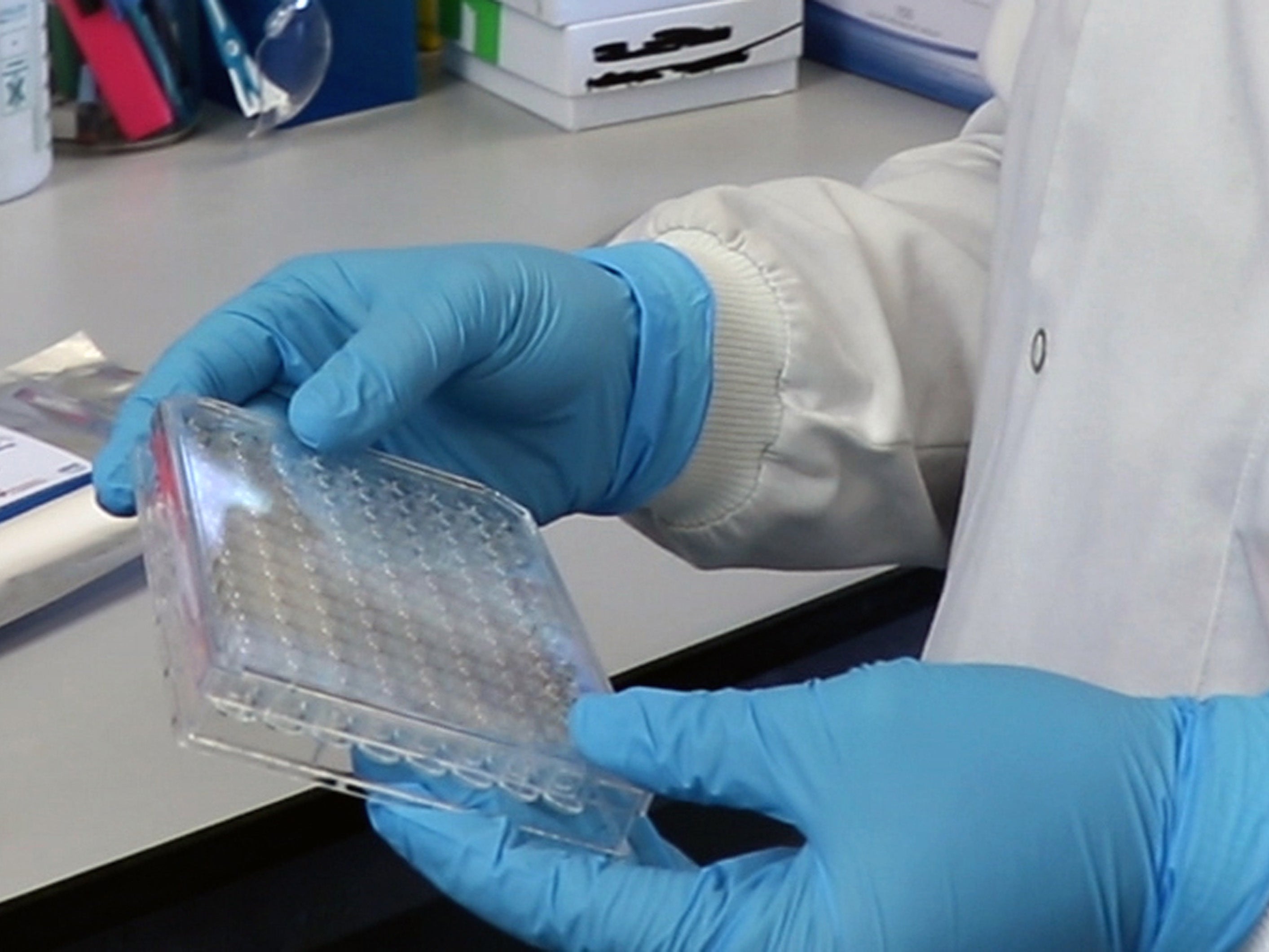 La infección previa no protege a largo plazo contra el covid, en particular las nuevas variantes, según un estudio