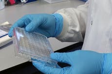 La infección previa no protege a largo plazo contra el covid, en particular las nuevas variantes, según un estudio