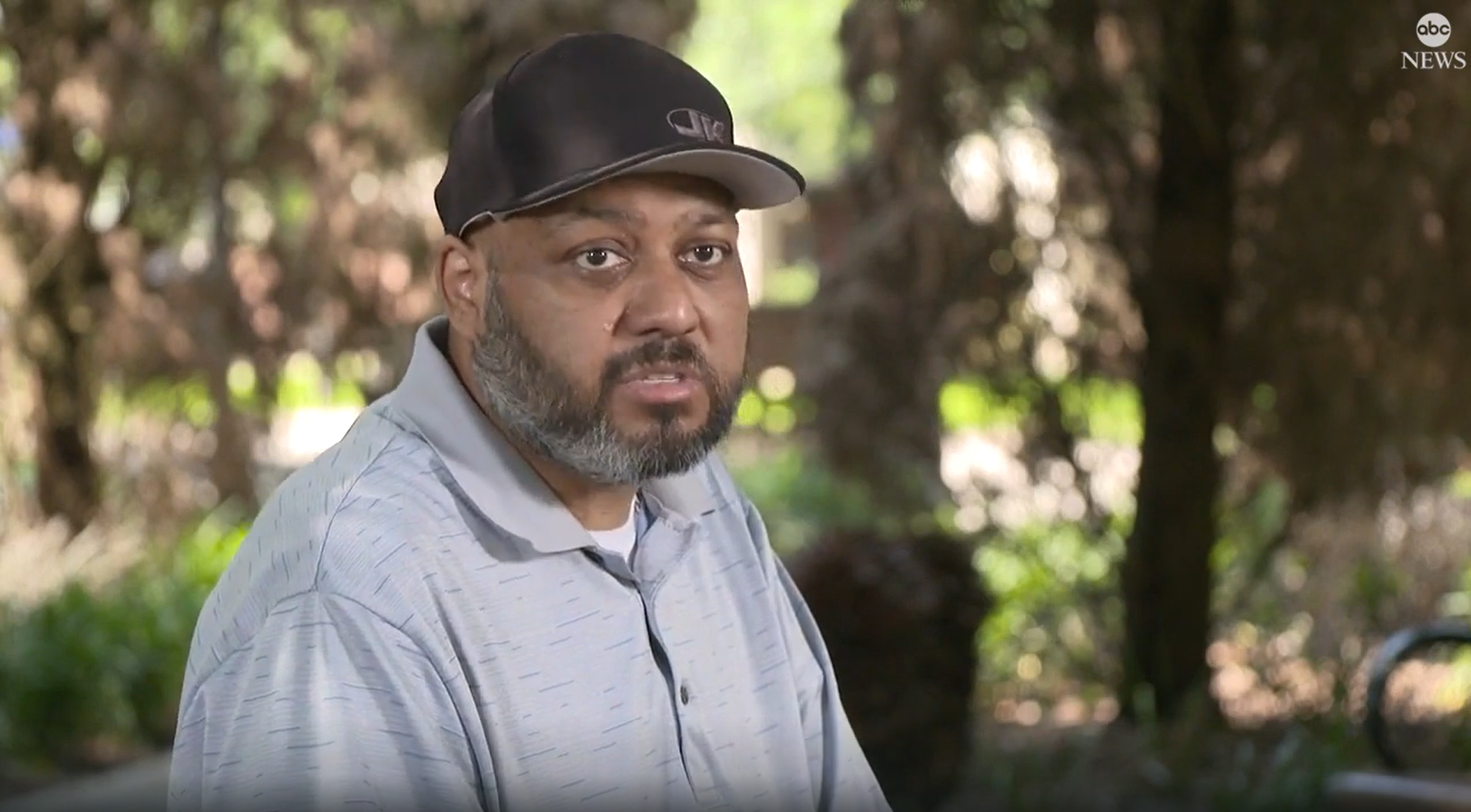 Hombre que rechaza vacuna covid-19 y termina con doble trasplante de pulmón 