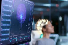 Microsoft rastreó la actividad cerebral de usuarios para registrar su “deleite” al usar Windows 11