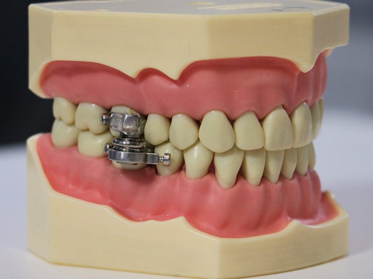 Organizaciones benéficas denuncian “dispositivo de pérdida de peso” que bloquea la mandíbula