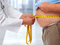 Científicos encuentran variantes genéticas que protegen contra la obesidad después de estudio masivo sobre ADN