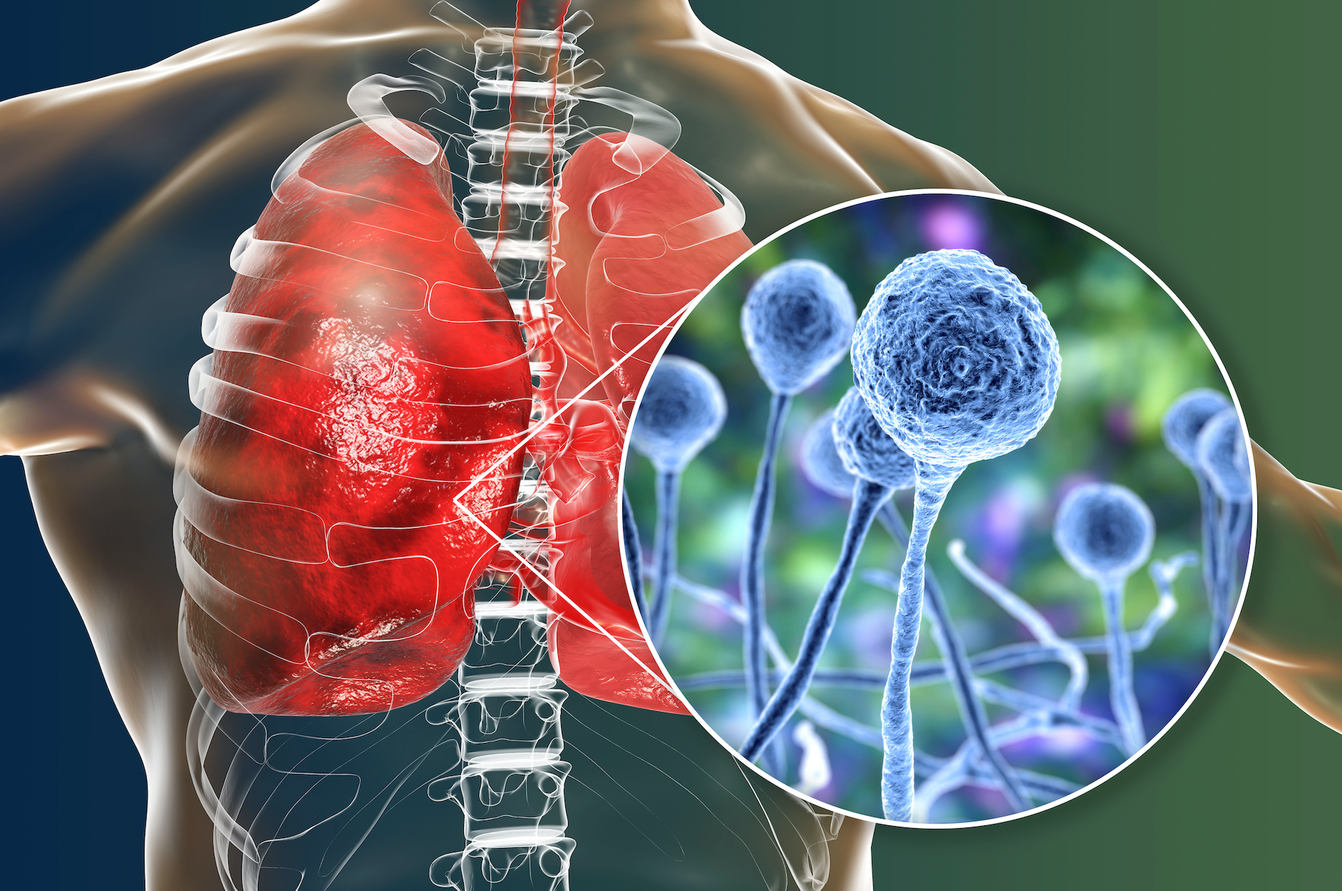 <p>Desde que inició la pandemia en marzo del año pasado, Guatemala registra un total de 305.319 casos confirmados y 9.548 fallecimientos a causa del virus.</p>