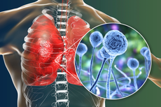 Guatemala registra primera muerte por “hongo negro”