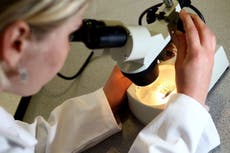 Nuevo tratamiento del cáncer de ovario reduce tumores en casi la mitad de las pacientes, según investigadores