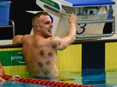 Tokio 2020: ¿Qué son las extrañas marcas en las espaldas de algunos nadadores?