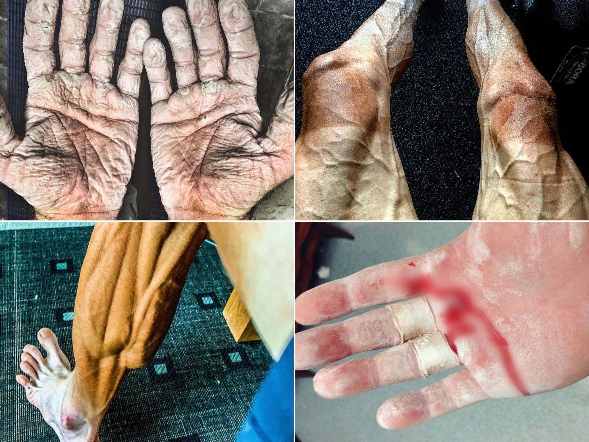 Atletas olímpicos comparten el costo que sus deportes tienen en sus cuerpos