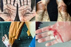 Atletas olímpicos comparten el costo que sus deportes tienen en sus cuerpos