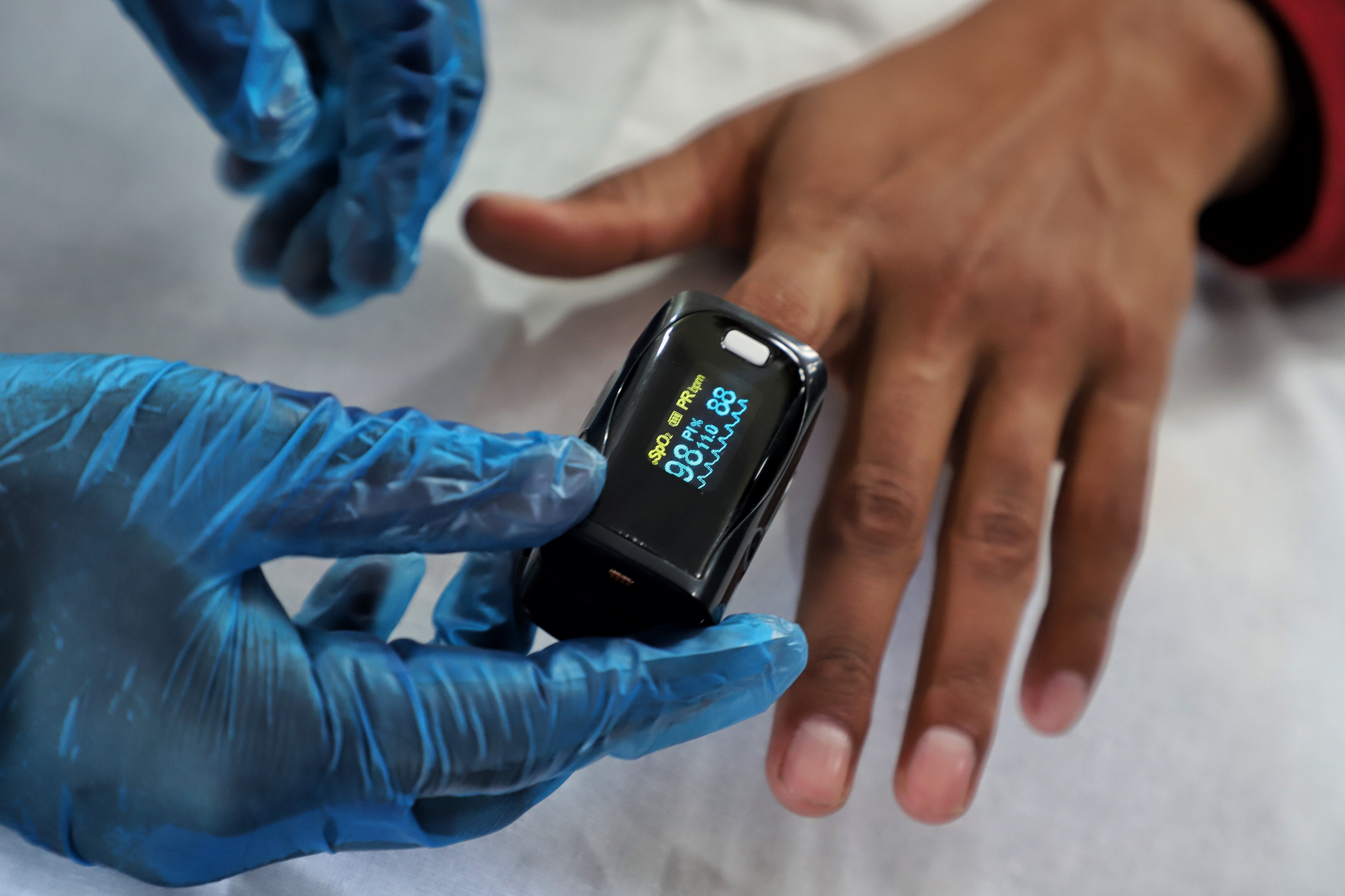 Pacientes asiáticos, negros e hispanos recibieron menos oxígeno por error en la lectura de oxímetros