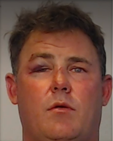 Hombre de Florida muerde la oreja a un amigo en pelea por mujer, dijo la policía