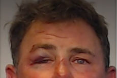 Hombre de Florida muerde la oreja a un amigo en pelea por mujer, dijo la policía