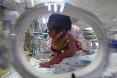 Bebé más pequeña del mundo, que al nacer pesó lo que una manzana, finalmente es dada de alta del hospital