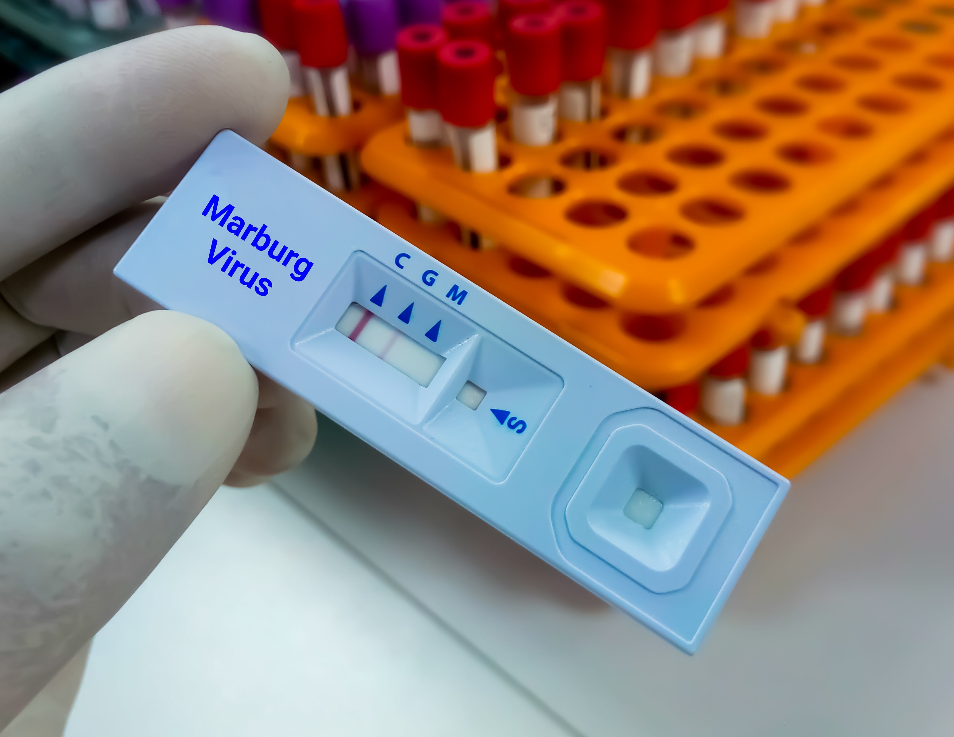 ¿Qué es el virus de Marburgo y por qué la OMS lanzó una alerta de transmisión?