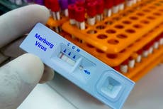 ¿Qué es el virus de Marburgo y por qué la OMS lanzó una alerta de transmisión?