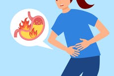 Acidez estomacal: causas, síntomas y remedios para aliviarla