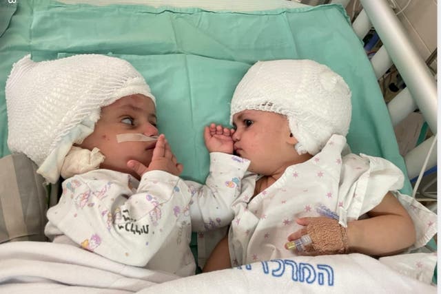 Antiguos gemelos israelíes siameses se conocen por primera vez después de haber sido sometidos a una rara cirugía de separación en el Centro Médico Soroka.