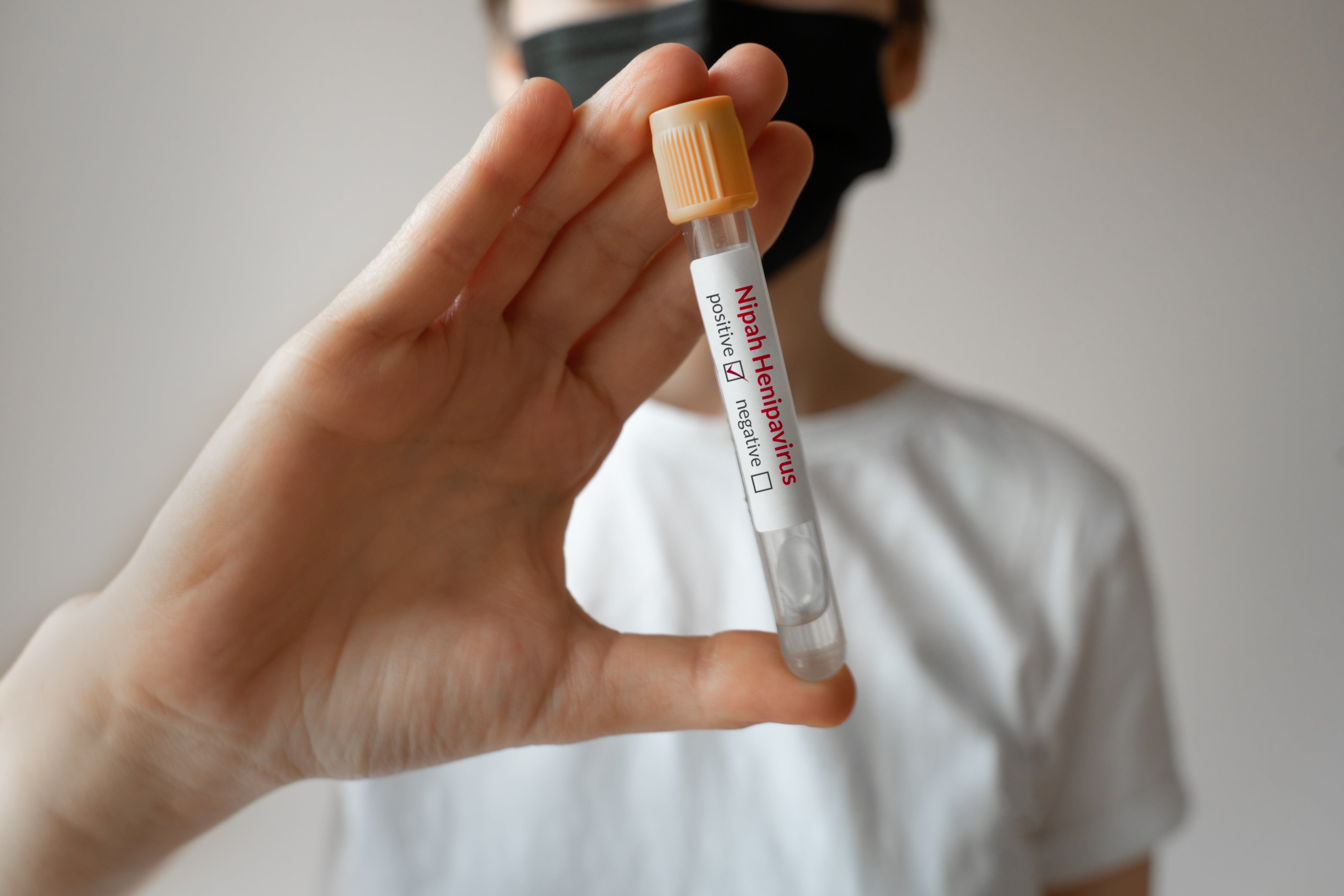 ¿Qué es el virus de Nipah y por qué puso en alerta a India?