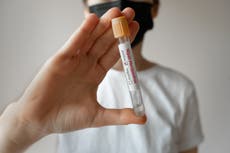 ¿Qué es el virus de Nipah y por qué puso en alerta a India?