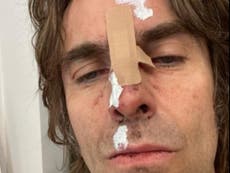 Liam Gallagher sufre lesiones tras ”caerse de helicóptero” después de su actuación en la Isla de Wight