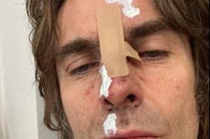 Liam Gallagher sufre lesiones tras ”caerse de helicóptero” después de su actuación en la Isla de Wight