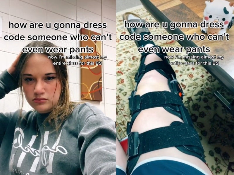 Adolescente con un aparato ortopédico en la pierna grita el código de vestimenta de la escuela