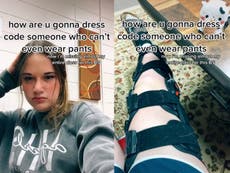 Estudiante con aparato ortopédico en la pierna crítica código de vestimenta de su escuela 