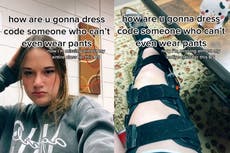 Estudiante con aparato ortopédico en la pierna crítica código de vestimenta de su escuela