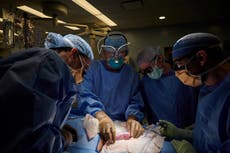 Cirujanos de EE.UU. realizan primera prueba de trasplante exitosa de riñón de cerdo en un ser humano