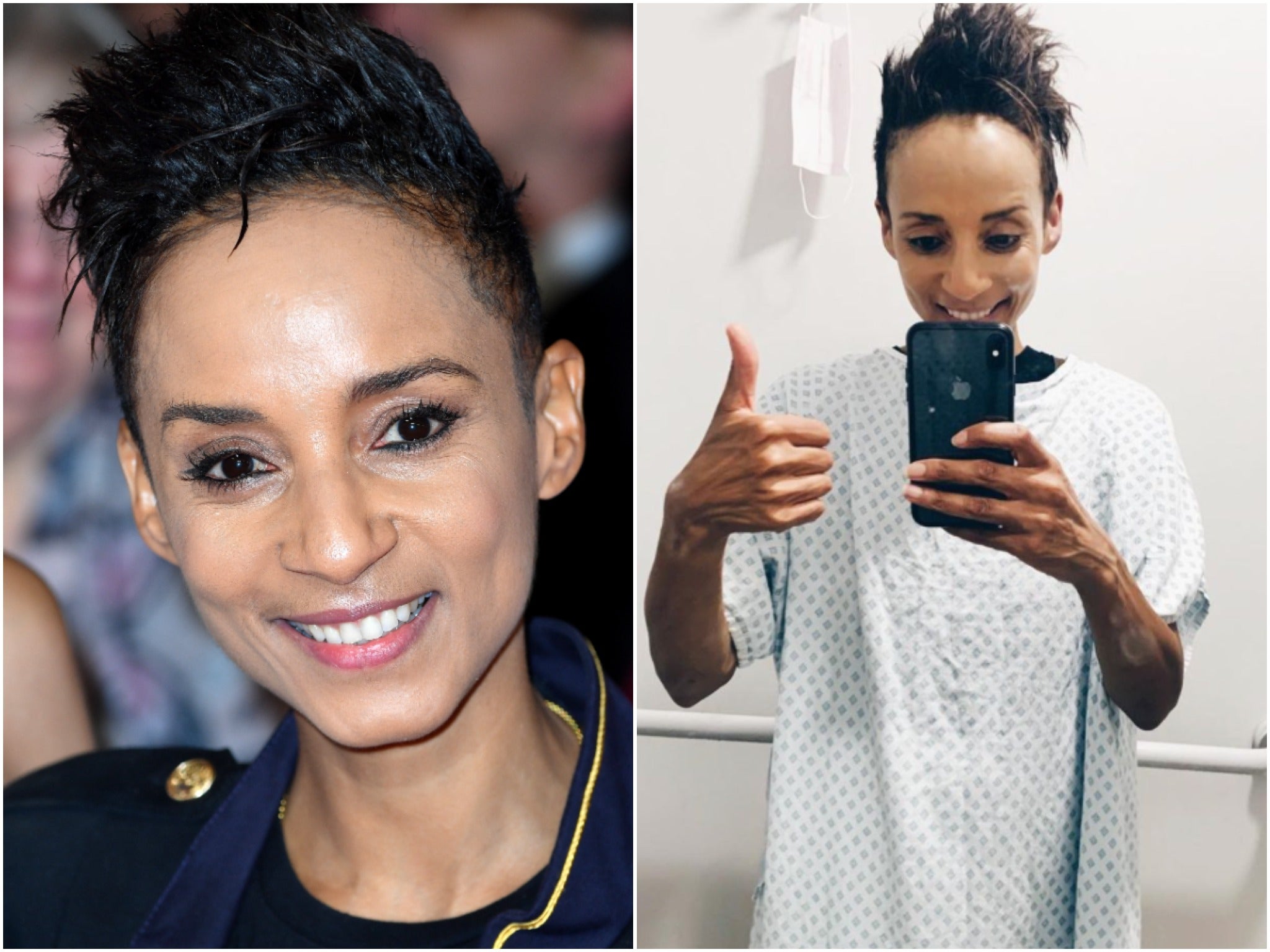 Las señales de advertencia de cáncer de intestino que no se deben ignorar tras el diagnóstico de Adele Roberts