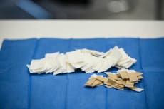 Vendaje inteligente revela el estado de cicatrización de la herida sin necesidad de que los médicos retiren el apósito